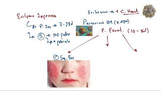 ERITEMA INFECCIOSO  PEDIATRIA [upl. by Soren]