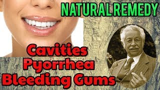 Healing Bleeding Gums Pyorrhea Cavities Naturally  Natural Herbal Remedies [upl. by Jannery]