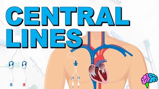 The Basics of Central Lines  Central Venous Catheters CVC [upl. by Ahsitnauq]