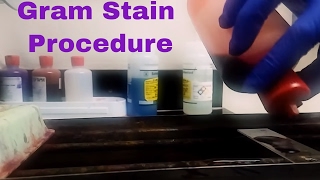 Microbiology Gram Stain Procedure Explained [upl. by Aztinaj]