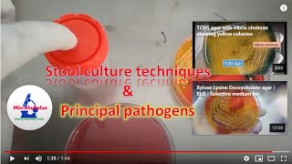 Stool culture techniques for isolation of enteric pathogens like Salmonella Shigella and Vibrio [upl. by Adnirod]