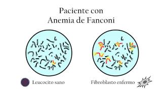 La Anemia de Fanconi  Diagnóstico genético [upl. by Meghann405]