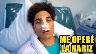 ASÍ QUEDÓ MI NARIZ DESPUÉS DE LA OPERACION [upl. by Ahsiri]