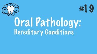 Oral Pathology  Hereditary Conditions  INBDE ADAT [upl. by Adoh]