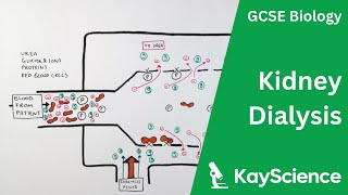 Kidney Dialysis  Biology GCSE  kaysciencecom [upl. by Kotta699]