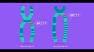 Gene BRCA versus risco de CÂNCER DE MAMA  Sarraff Medicina Curitiba [upl. by Eltsyrhc]