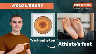 Trichophyton 🦠  📚Mold Library  Mold Busters [upl. by Ritz]