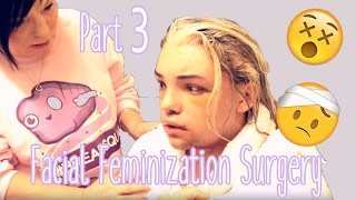 Facial Feminization Surgery  Day 5 amp 6 GRAPHIC  Stef Sanjati [upl. by Ollie]