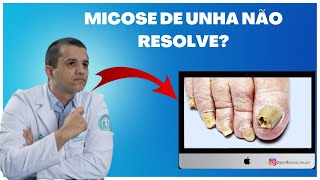 Receita para CURAR MICOSE DE UNHA e Acabar com os Fungos [upl. by Novelc]