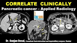 Applied radiology  pancreatic CT reading on console  Correlate clinically CT scan of the pancreas [upl. by Irreg]