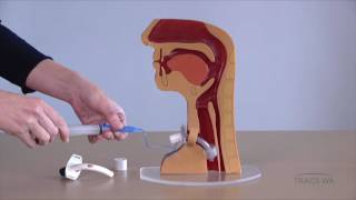 Tracheostomy  Respiratory phonatory and swallowing function  TRACS WA [upl. by Schweiker425]