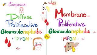 Diffuse Proliferative Glomerulonephritis vs Membranoproliferative Glomerulonephritis  DPGN vs MPGN [upl. by Ignacius]