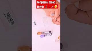 Peripheral blood smear dmlt bmlt viralvideo medicalstudent medical viral reelsshorts💉🩸😊 [upl. by Eslud187]