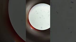 Gram positive rods Bacillus sp under Gram staining [upl. by Mccully]