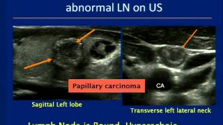 Thyroid Ultrasound Course [upl. by Sellma]