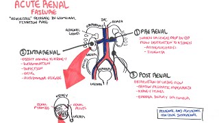 Acute Renal Failure [upl. by Mehsah]