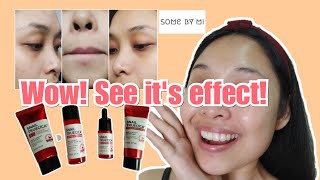 Review Some By Mi Snail Truecica Miracle Repair Toner  di kulit berjerawat oily sensitif [upl. by Corell]