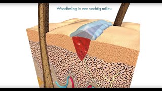 Flamigel  Vochtige wondheling met Flamigel [upl. by Tessler]