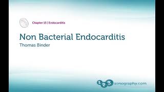 Echocardiography Non Bacterial Endocarditis Concise Explanations and Demonstration [upl. by Essy]