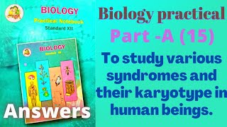 To study various syndromes and their karyotypes in human beings class 12 Biology practical Part A 15 [upl. by Tebazile]