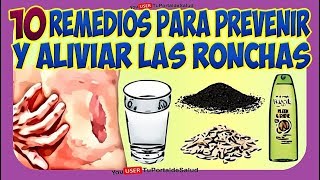 10 Remedios para Aliviar las Ronchas  Tratamientos para la Urticaria Ronchas Picazon de Piel [upl. by Chloette60]