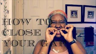 HOW I CLOSED MY GAP WITHOUT BRACES  RANT [upl. by Arres]