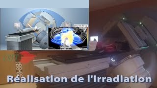 réalisation dune séance de radiothérapie en modulation dintensité rotationnelle au CRTT de Versail [upl. by Cassilda304]