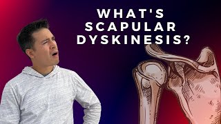 Scapular Dyskinesis and Shoulder Pain [upl. by Ellon895]