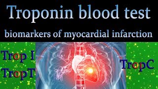 Troponin blood test  Biomarkers of myocardial injuryCardiac biomarker [upl. by Rebekkah556]