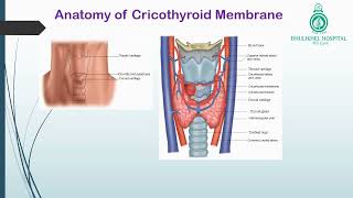 Cricothyroidotomy [upl. by Mateo]