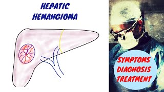 Hepatic Hemangioma  Liver Hemangioma [upl. by Inor348]