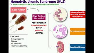 Hemolytic uremic syndrome  HUS  mrcpch Recall Communication [upl. by Issac]