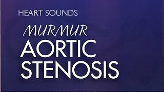 Aortic Stenosis Murmur  With Murmur Sounds Audio Mrrmurs Made Easy [upl. by Domash]