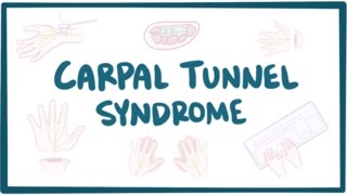 Carpal tunnel syndrome  causes symptoms diagnosis treatment amp pathology [upl. by Ailad]