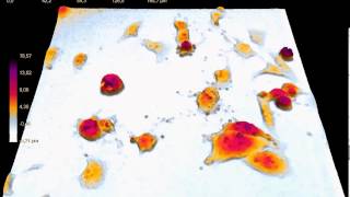 Cellular apoptosis imaged by holographic microscopy [upl. by Aleciram485]