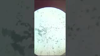 blood corpuscles using Leishman s stain part2 short video [upl. by Akinert]