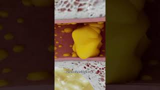 How to Remove Ear Wax Blockage the Right Way shorts facts  creativelearning3d [upl. by Rye]