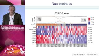 Should RCHOP Remain the Standard of Care for DLBCL [upl. by Nimrahc]