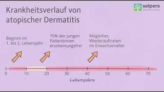 Ist Neurodermitis heilbar  Krankheitsverlauf von atopischer Dermatitis Arzt erklärt [upl. by Eillod]