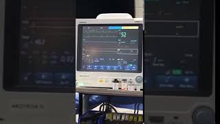 ECG minutes after euthanasia  Veterinary Video [upl. by Rossner83]