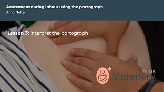 Assessment during labour using the partograph [upl. by Ceciley468]