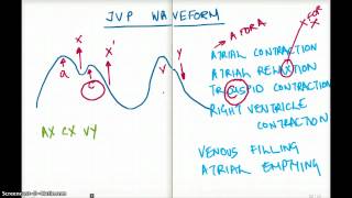 EASY WAYS TO REMEMBER JVP WAVEFORM [upl. by Nellek]