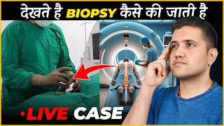 How Bone Marrow Biopsy Is Being Performed  Dr Gaurav Gangwani Interventional Radiologist [upl. by Anyahs]