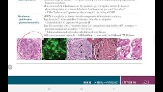 Acute Postsreptococcal Glomerulonephritis  BACK BENCHERS ACADEMY  First Aid USMLE Step 1 [upl. by Vashti]