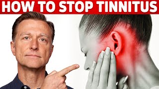 How to Stop Tinnitus ringing in the ears – Try DrBergs Home Remedy to Get Rid of It [upl. by Molloy]