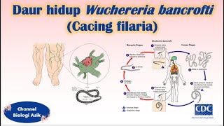 Daur hidup Wuchereria bancrofti Cacing filaria  Biologi 10 SMA [upl. by Delaryd]