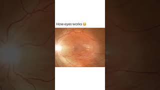 How your eyes work education optometry eye eyecare viral optometrists shortsvideo [upl. by Jakie694]