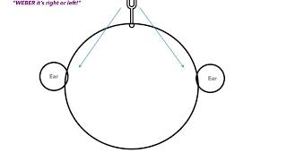 Weber vs Rinne Test amp Conductive vs Sensorineural Hearing Loss [upl. by Yboj611]