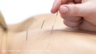 Holistic Healing Music for Acupuncture Session Spa Massage Therapy Music [upl. by Ingham271]