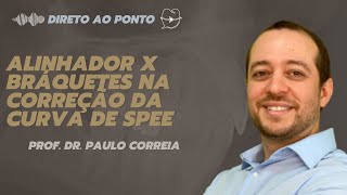 Alinhador x Bráquetes na correção da Curva de Spee [upl. by Notrub]